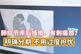 肺结节术后咳嗽、呼吸有刺痛感？医生：大多有这种情况，不必担忧视频封面