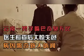 云南一男子嘴巴奇臭无比，医生检查后大惊失色，病因离奇骇人听闻视频封面