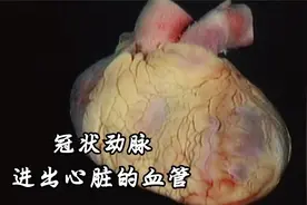 冠状脉和进出心脏的血管视频封面