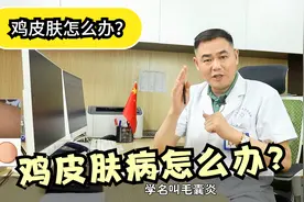 干货：得了鸡皮肤病怎么办？医生来告诉你常用的治疗方法及护理