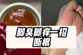 一个方法轻松断根脚臭脚痒！碘伏真的太绝了！爱了爱了视频封面