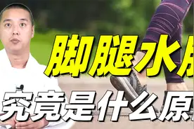 腿脚水肿，腿脚冰凉，这都是体内水湿太多了，告诉你水肿常见因素视频封面