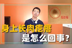 身上长“肉疙瘩”是怎么回事？到底是不是肿瘤？医生教你怎么治视频封面