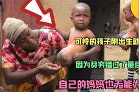 可怜的孩子刚出生就患病，因为贫困错过了最佳治疗视频封面