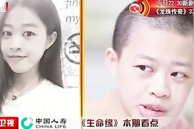 妙龄少女1：少女罹患世界罕见的巨型肿瘤，比成年人的拳头还大！视频封面