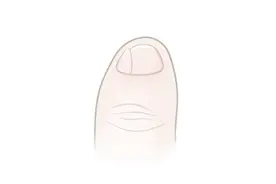 小脚趾的指甲分成两瓣，能说明自己是汉族人吗？专家另有解释视频封面