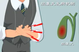 张一山患胆囊炎？恶心腹痛内含真相？胆囊是如何一步步癌变的？视频封面