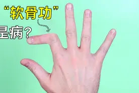 为什么有的人手指能大幅度弯曲，有的人却做不到？这样是不健康？视频封面