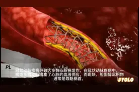 在睡眠中死亡的 8 个常见原因，身体出现什么情况导致猝死