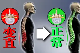 久坐腰痛？可能腰椎曲度变直，针对训练有效改善腰椎曲度视频封面