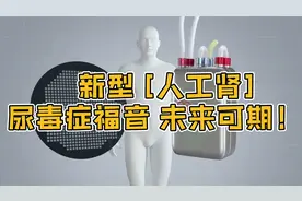 未来可期：新型人工肾，尿毒症福音视频封面