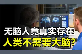 “无脑人”竟真实存在，难道人类可以不需要大脑？
