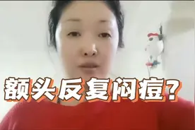 额头反复长痘闷痘太烦人了！教你一个好方法，帮你消炎控痘控油视频封面