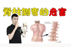 脊柱一弯就难看，脊柱侧弯的危害与矫正我来告诉你！视频封面