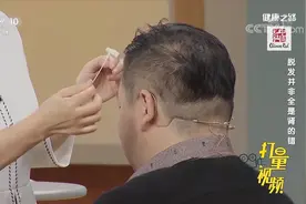 脱发怎么办？专家推荐几个穴位，用梳子刮一刮大有好处|健康之路