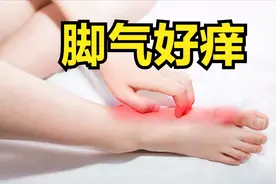 脚气又痒又爆皮，达克宁和特比萘芬哪个见效快？还你双干净的脚丫视频封面