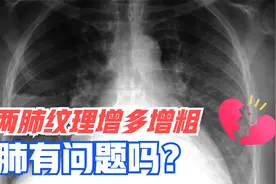 报告写“两肺纹理增多增粗”，肺有问题么？浙大医学博士答疑视频封面