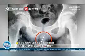 南京：太危险！13岁男孩尿道里取出近9厘米长钢针视频封面