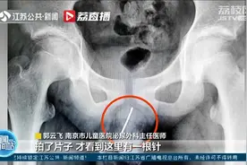 南京：太危险！13岁男孩尿道里取出近9厘米长钢针视频封面