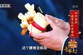 弯腰不仅腰疼还会腿疼？警惕这种最常见的腰病视频封面
