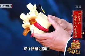 弯腰不仅腰疼还会腿疼？警惕这种最常见的腰病视频封面