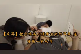 【采耳搬运】千年巨型的耳結石出生了【转载】