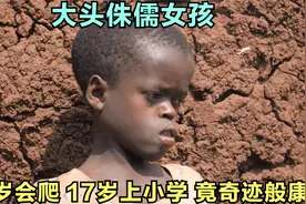 非洲纪录片：大头侏儒女孩6岁才会爬，母亲独养6子，竟有奇迹出现视频封面