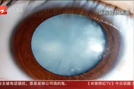 可乐当水喝 15岁少年得糖尿病右眼几乎失明视频封面