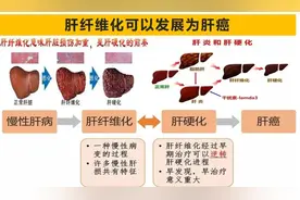 肝纤维化是怎么回事？严重的可以导致肝癌，需要引起每个人的重视
