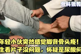 年轻小伙突然感觉脚背骨头疼！医生看片子没问题，怀疑是尿酸问题视频封面
