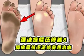脚底厚茧死皮严重，师傅耐心修剪超治愈，最后就像换了一只脚一样视频封面