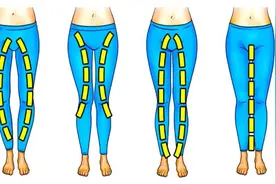 为什么会出现X/O-XO型腿？矫正腿型前，这三个要素你要先知道