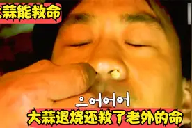 大蒜居然能退烧，还救了老外的命，大蒜真的这么神奇吗？视频封面