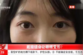 戴眼镜时间长了，会让眼睛变形？医生斩钉截铁说出答案！视频封面