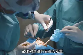 医院切除的人体部位，都是怎么处理的？