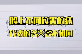 脸上不同位置的痣，代表的含义各不相同，看看你是哪一种？视频封面