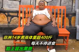 非洲14岁男孩体重超400斤，每天不停进食，脸上冒出黑斑，纪录片视频封面