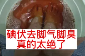 脚上瘙痒脚臭怎么办？分享一招快速根除！真的好用视频封面