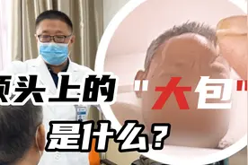 肝癌转移后脑袋鼓起一个大包？这究竟是怎么回事儿视频封面