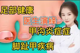 医学解读 脚趾甲炎症 架构炎症是怎么样的症状  看医生如何处理视频封面