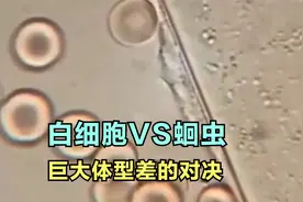 一只笨手笨脚的白细胞，翻山越岭来消灭体型相差悬殊的蛔虫！