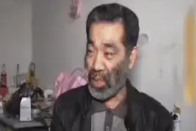 父女二人全身长满毛发 父亲带着女儿去医院检查 竟是返祖现象