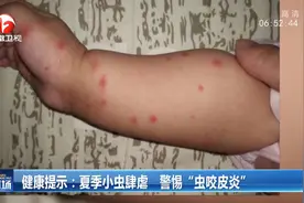 夏季小虫肆虐，警惕“虫咬皮炎”，医生建议做好这几点