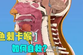 鱼刺卡喉是喝醋、吞饭还是塞大蒜？NO！专家教你三招科学自救妙招视频封面