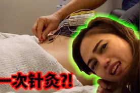 在美国找个陌生人，请她去做一次针灸是什么体验？视频封面