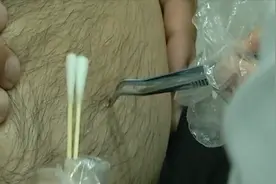男子扫墓过后“肚子出现黑斑”可把他吓坏了视频封面