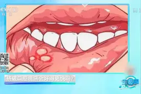 口腔溃疡是种什么病，长期不愈真的会癌变？专家权威解答|生活圈视频封面