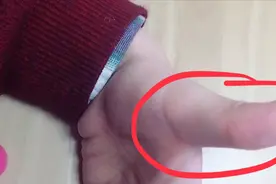 手中大拇指代表了什么，什么样的大拇指可以得长辈的爱护呢