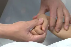 九岁女童右手突然丧失功能，送医检查发现与蛇有关视频封面