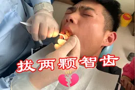 小伙拔了牙不能吃饭，饿到晚上买来一堆小吃滋补！只能用半张嘴吃